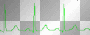 pulse