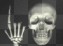 bones2