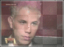 RBD