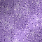 glitter