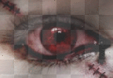 bloody red eye