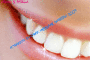 miss/mr sorriso 2007