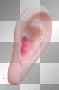 huge right ear