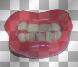 ugly teeth